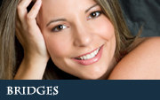 Bridges