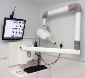 dental-digital-x-rays-image