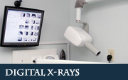 digital-xrays